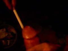 Cigarette burn penis