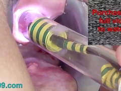Endoscope Camera into Peehole, Woman Pee Hole Playing